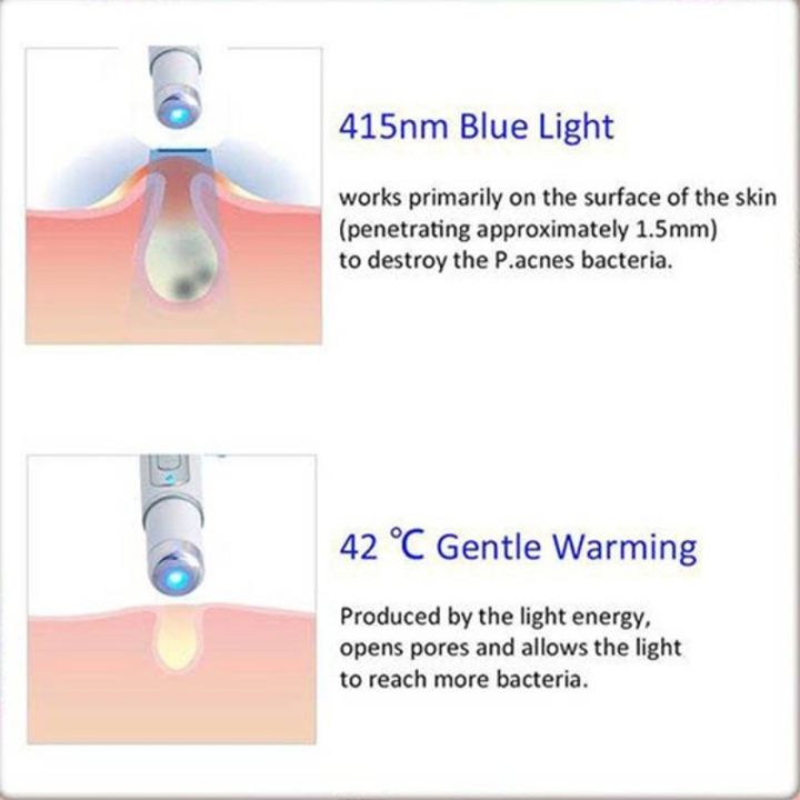 blue-light-therapy-เส้นเลือดขอด-การรักษากำจัดเลเซอร์สิวปากกาเลเซ-เลเซอร์กำจัดสิวจุดด่างดำ