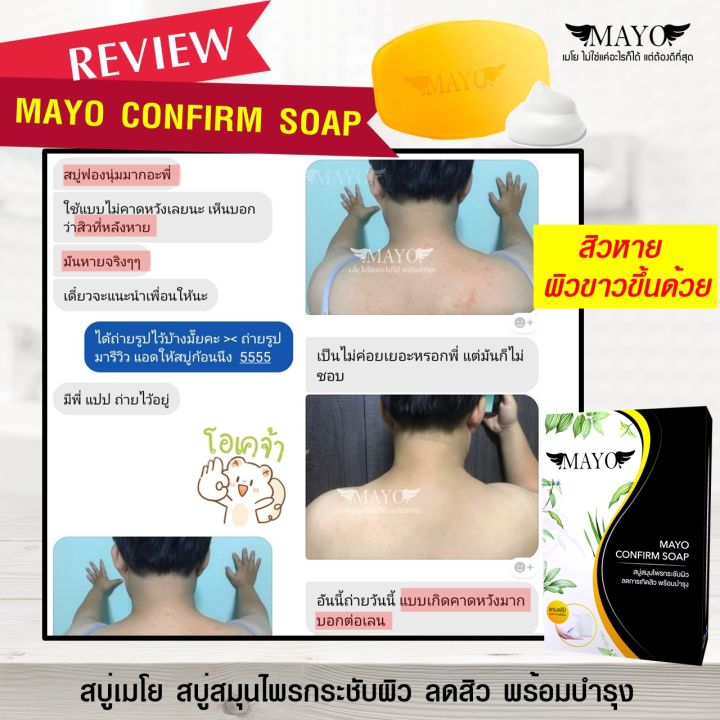 สบู่เมโย-หน้าใส-กระชับผิว-ลดสิว-พร้อมบำรุงให้ขาวใส-mayo-soap-สารสกัดจากธรรมชาติมากกว่า-10-ชนิด