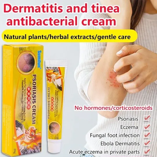 GiiMall 【2PCS】Dermatitis and Tinea Antibacterial Psoriasis Cream | Lazada