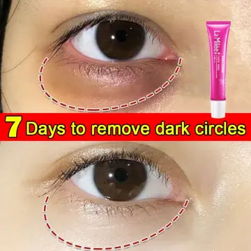 How to Remove Dark Circles From Photos Easily in 2024