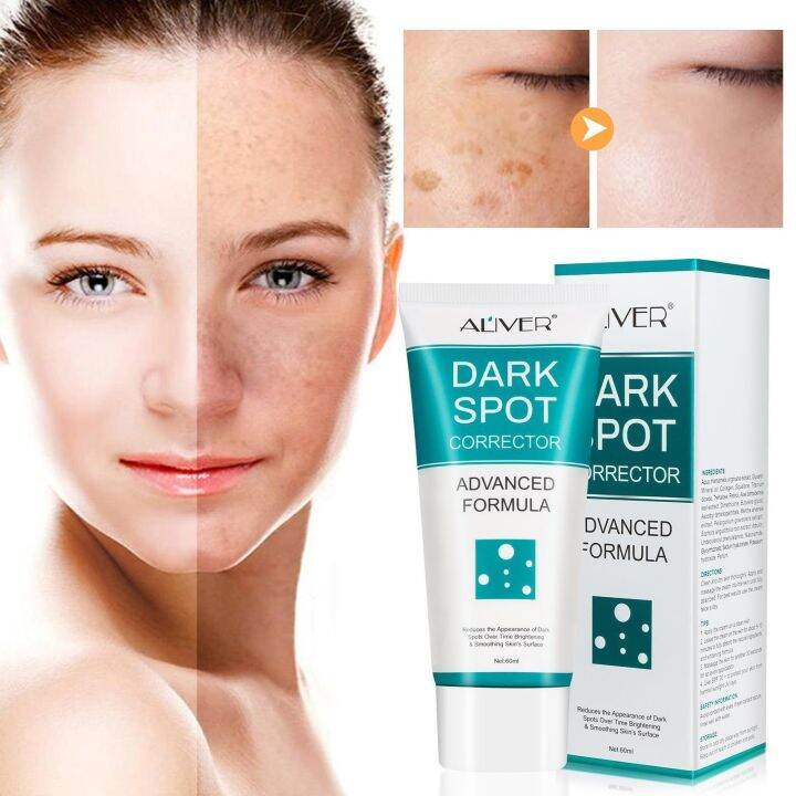 60ml Whitening Freckle Cream Spot Corrector Face Moisturizing Remove Dark Spots Melanin Melasma