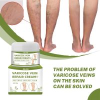 Varicose Vein Cream Spider Vein Cream ขาบวมไส้เดือนขาบรรเทา Phlebitis Angiitis ปรับปรุงการไหลเวียนโลหิต