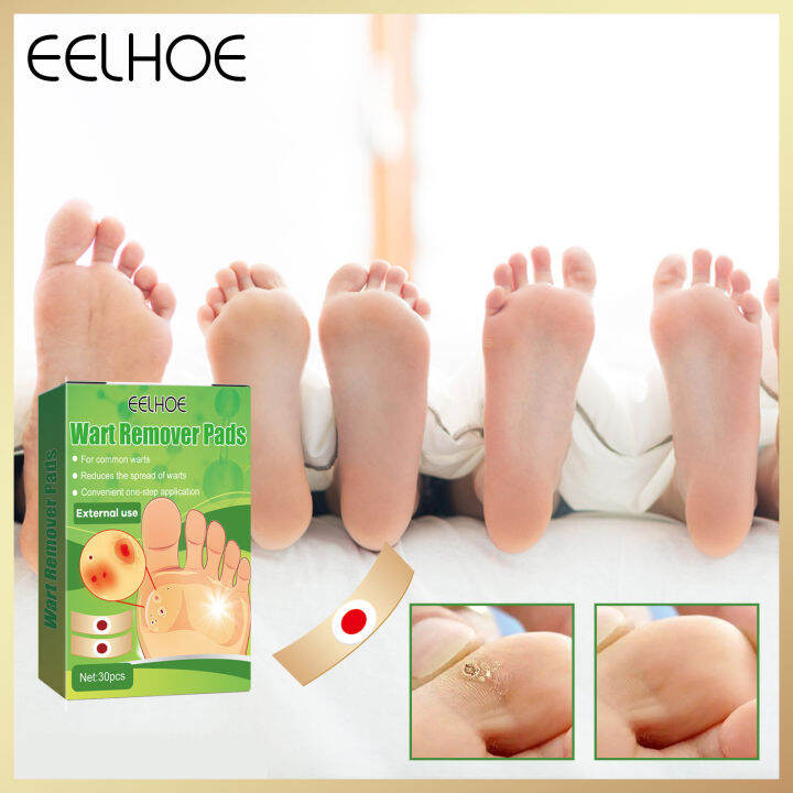 Eelhoe Wart Remover Patch Skin Tag Removal Kit Skin Tag Remover Patch ...