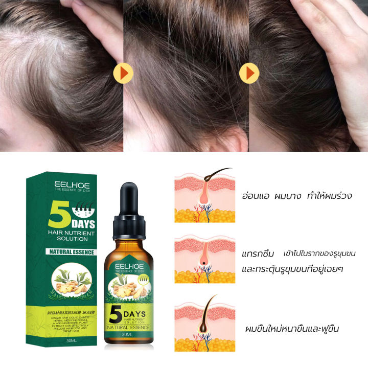 บอกลาหัวล้าน-eelhoe-เซรั่มปลูกผม-30มลส่งเสริมการเจริญเติบโตของเส้นผมตามธรรมชาติป้องกันผมร่วงแก้ปัญหาผมร่วง-น้ำยาปลูกผมชาย-น้ำยาเร่งผมยาว-น้ำยาปลูกผม-ยาปลูกผมของแท้-ยาปลูกผม-ปลูกผมเร่งด่วน-เซรั่มเรงผมย