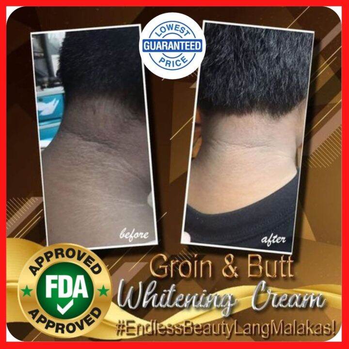 Bleaching Advanced Groin Butt Nape Neck Singit Batok Whitening Cream