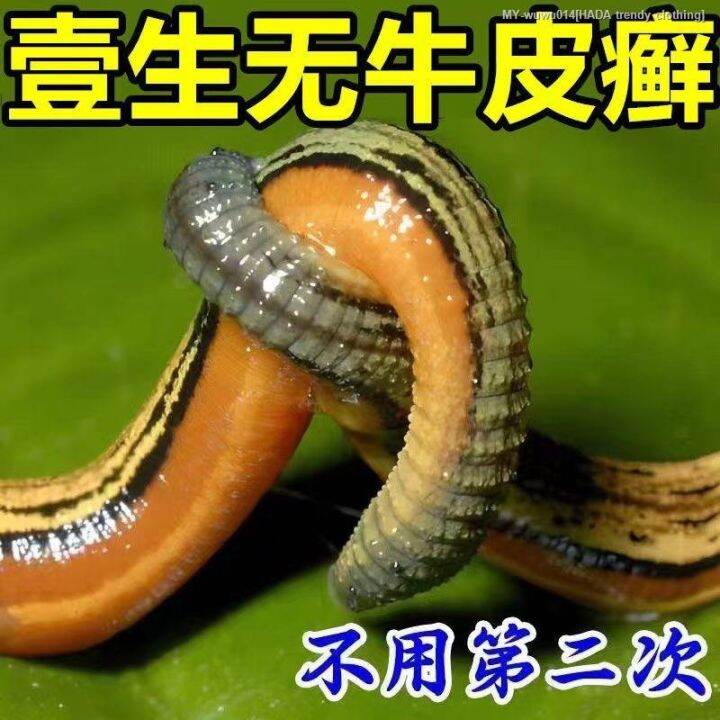 Psoriasis dermatitis eczema special antipruritic sweat herpes fungal