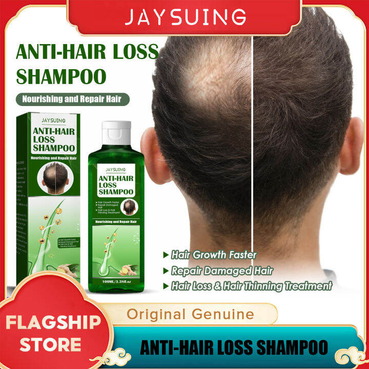 Jaysuing Hair Shampoo Conditioner Hair Loss Prevents Scalp Treatments ...