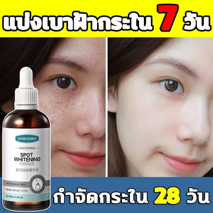 สินค้าแนะนำ-เซรั่มไวท์เทนนิ่ง-qiskinbo-ฝ้า-กระ-จุดด่างดำ-ปรับปรุงความหมองคล้ำ