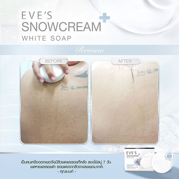 อีฟส์-สบู่อีฟส์สบู่ลดสิว-เป็นสิวที่หลัง-สบู่-ฟอกตัว-ครีมอาบน้ำ-snowcream-white-soap