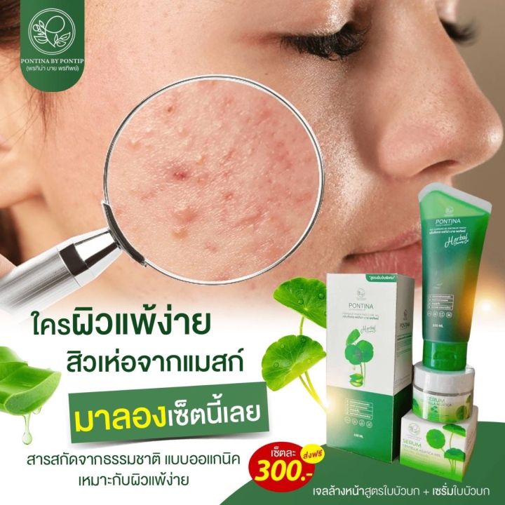 จับคู่ส่งฟรี-ลดสิวเซรั่มใบบัวบก-เจลล้างหน้าใบบัวบก-สิวอักเสบ-สิวอุดตัน-หน้ามัน-รูขุมขนกว้าง