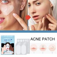 【CW】 80Pcs Invisible Acne Stickers Concealer Face Spot Scar Stickers Makeup Invisible Net Acne Stickers Hydrocolloid Oil Acne Sticker