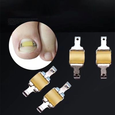 21-23Mm Toe Correction Tool For Foot Therapy Professional Toe Correction And Foot Care Tool For Restoring Embedded Toes