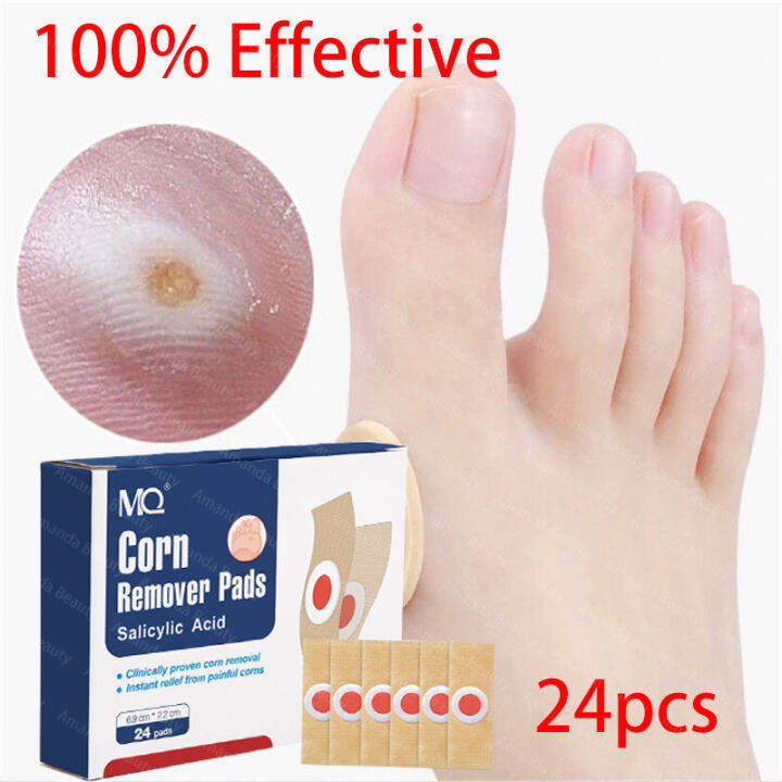 Warts Foot Care Foot Corn Removal Plaster Warts Thorn Patch Foot Corn ...