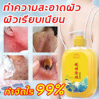 TANYA สบู่กำมะถัน ครีมอาบน้ำหอมๆ408ml ลบสิวควบคุมน้ำมัน ปรับสี ขจัดกลิ่นเหงื่อ ชะล้างรูขุมขน พร้อมฟื้นบำรุงผิว สบู่เหลวซัลเฟอร์ เจลอาบน้ําฆ่าเชื้อ สบู่สิว สบู่ฆ่าเชื้อ ไรกํามะถัน เจลทําความสะอาดผิวอาบน้ํา ล้างร่างกายกําจัดไร ฆ่าเชื้อไร เจลอาบน้ํากํามะถัน