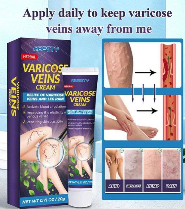Varicose Vein Massage Gel Vein Soothing Cream Lazada PH