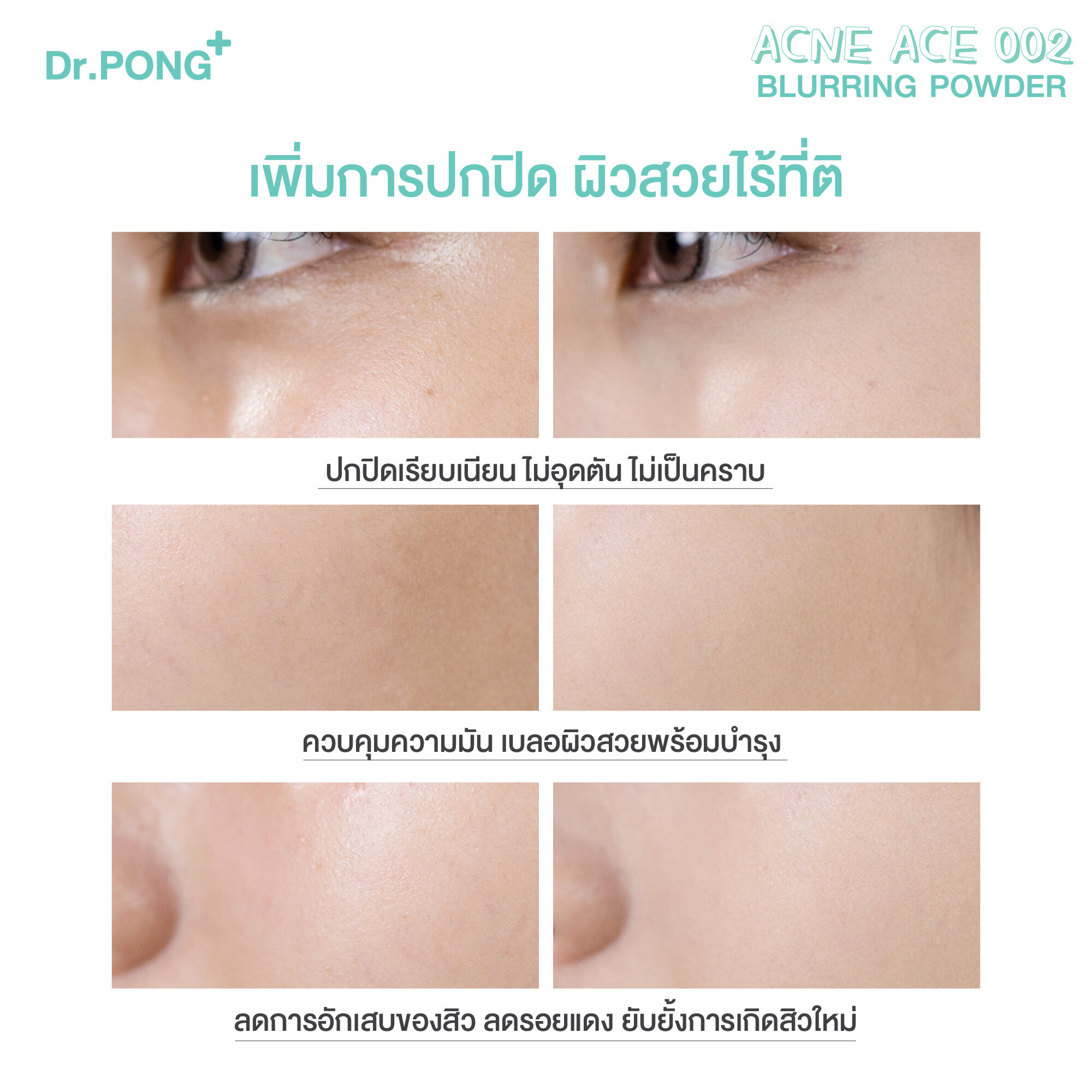 สูตรลดสิว