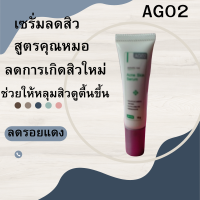 AG02 ครีมรักษารอยแผลสิว สูตรคุณหมอ.ใช้ลบรอยดำรอยแดงรอยหลุมลึกให้ตื้นขึ้น ช่วยผลัดเซลล์ผิวหลังสิวหาย)