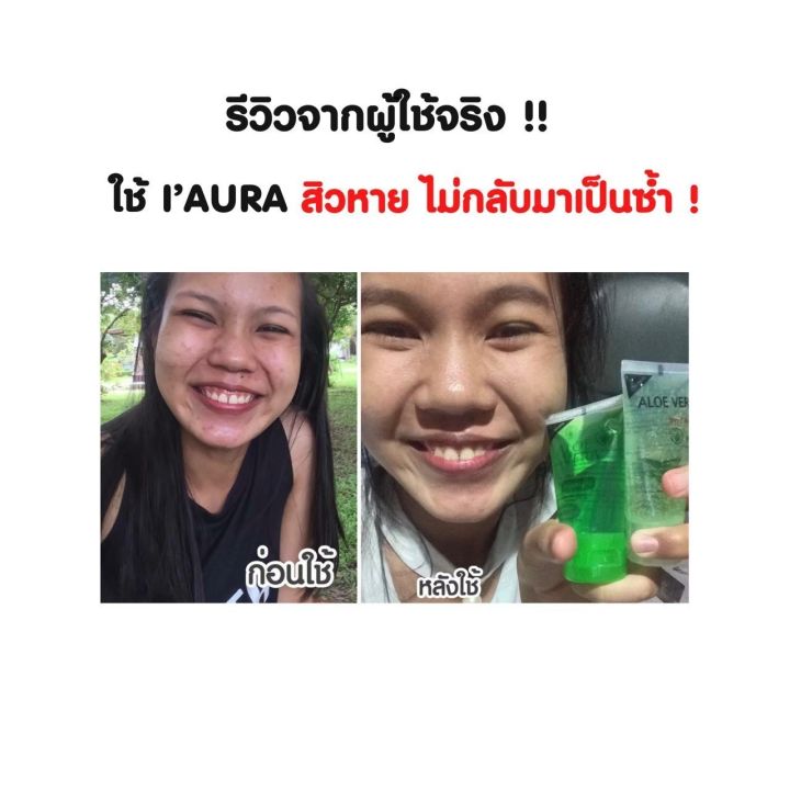 แพ็คเกจใหม่-i-aura-aloe-vera-cleansing-gel-เจลล้างหน้าว่านหางจระเข้-คลีนซิ่ง-50-g