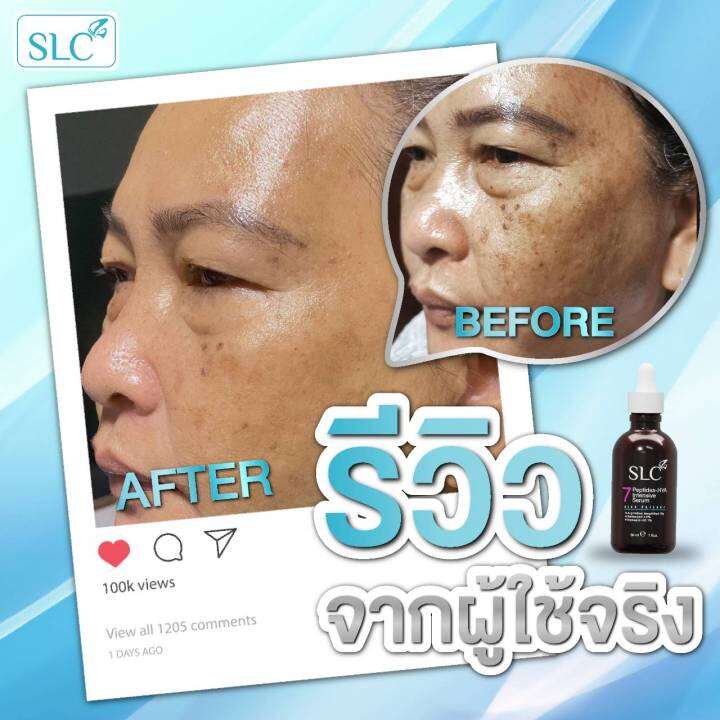 เซรั่มหน้าตึง-ยกกระชับใบหน้า-ลดริ้วรอย-slc-serum-จาก-slc-clinic-2-แถม-4-ส่งฟรี-ไม่เห็นผลยินดีคืนเงิน