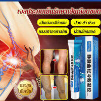 vivistyle เจลแก้ปัญหาการทำงานของเส้นเลือดในขา