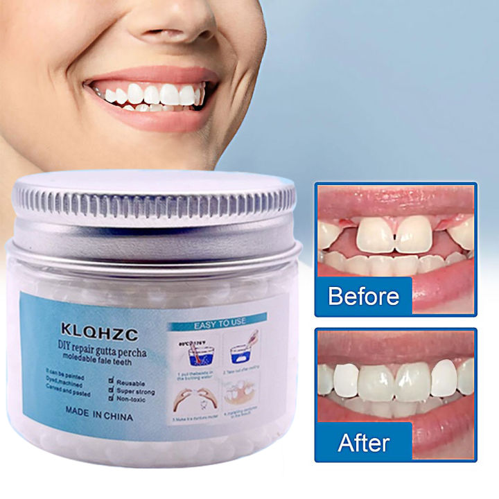 Tooth Repair Kits, Tooth Repair Moldable Fake Teeth, Dental Repair