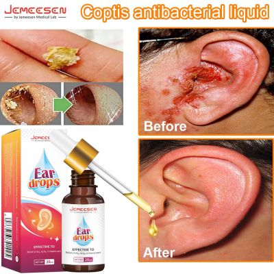 20ml Tinnitus Ear Drops Ear Ringing Gentle Relieving Health Discharge Care Tinnitus Fluid Ear Ear Deafness Swelling Otitis Care