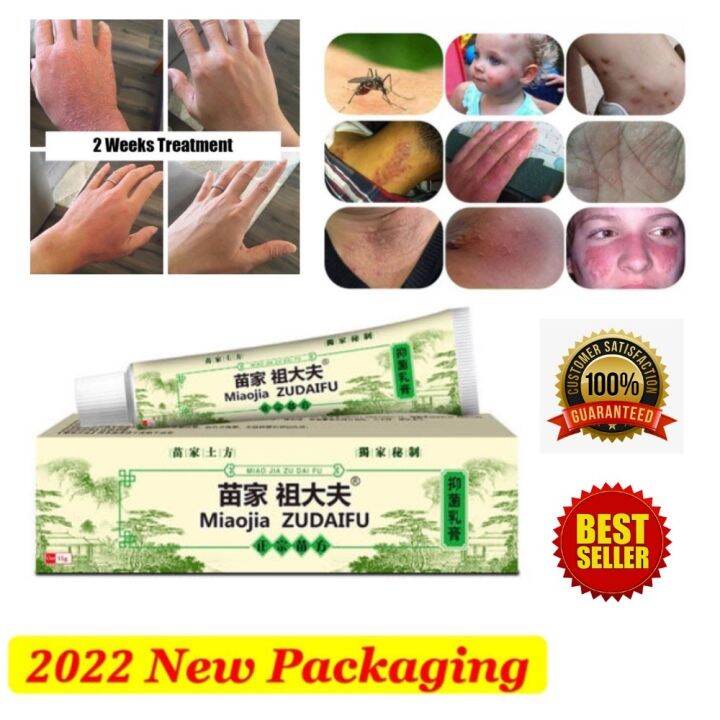 15g zudaifu chinese herbal skin psoriasis cream dermatitis eczematoid ...
