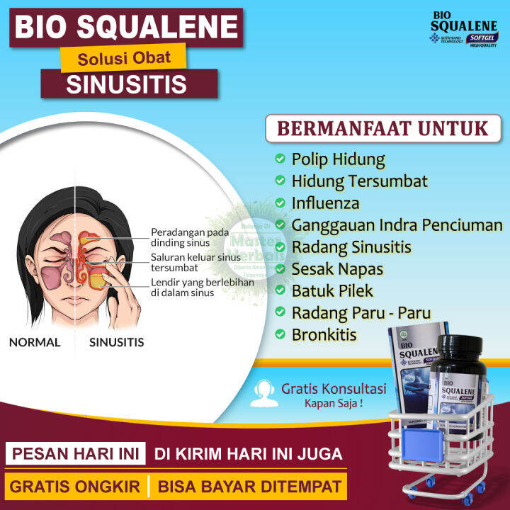 Obat Sinusitis Radang Sinus Anak Dewasa Polip Hidung Pilek Flu Menahun ...