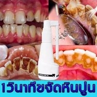 ⚡️เอาหินปูนออกใน 1 วินาที⚡️น้ำยากำจัดหินปูน30ML ขจัดคราบหินปูน น้ำยากำจัดหินปูน ยาสีฟันฟอกฟันขาว กําจัดนิ่วในฟัน ยาสีฟันฟันขาว ซ่อมฟันเหลือง ฟันขาวขึ้น น้ำยาขัดฟันขาว หินปูน Dental stone spray