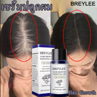 BREYLEEเร่งผมหนา?เซรั่มปลูกผม ฟื้นฟูผมแห้งเสีย แก้ปัญหาผมร่วง ลดผมร่วง บำรุงรากผม แตกปลาย ป้องกันผมร่วง( น้ำยาปลูกผม ทรีทเมนต์สำหรับผม ป้องกันหัวล้าน นำ้ยาปลูกหนวด เซรั่มบำรุงผม น้ำปลูกผม ยาปลูกผมของแท้)ทรีนเมนบำรุงผมHair Growth Essential Oil