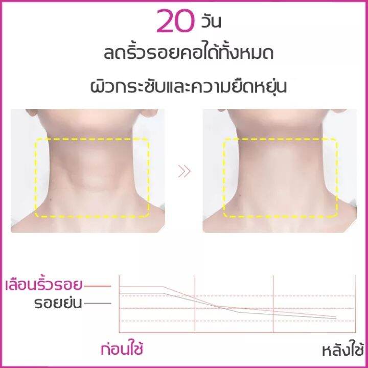 sakose-บำรุงผิว-ยกกระชับผิวคอ-ครีมทาคอ-50g-ครีมทาคอให้ตึง-ครีมบำรุงคอ-ซึมง่าย-ไม่มันเยิ้ม-ครีมบำรุงลำคอ-neck-cream