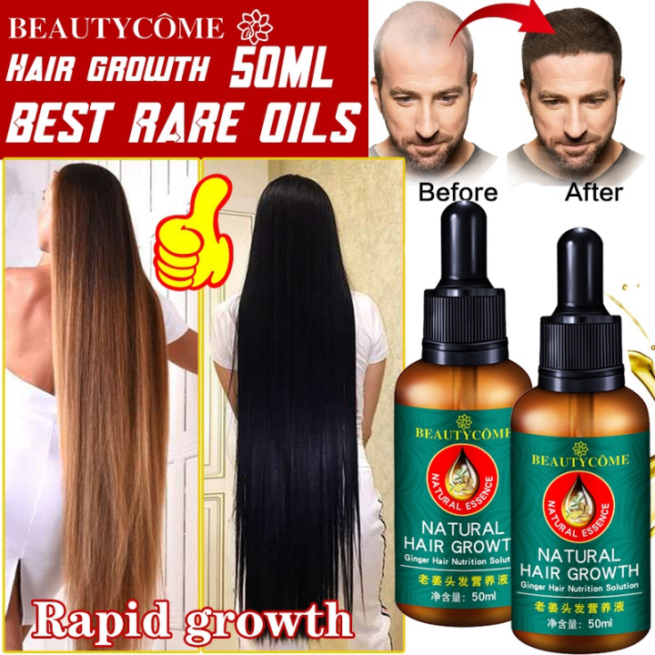 Ginger Hair Growth Essence Anti Hair Loss Serum Fast Hair