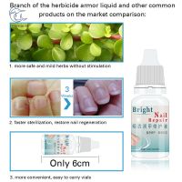 10ml Nail Fungal Treatment Anti Fungus Onychomycosis Removal Toenail Care Nails Repair Liquid