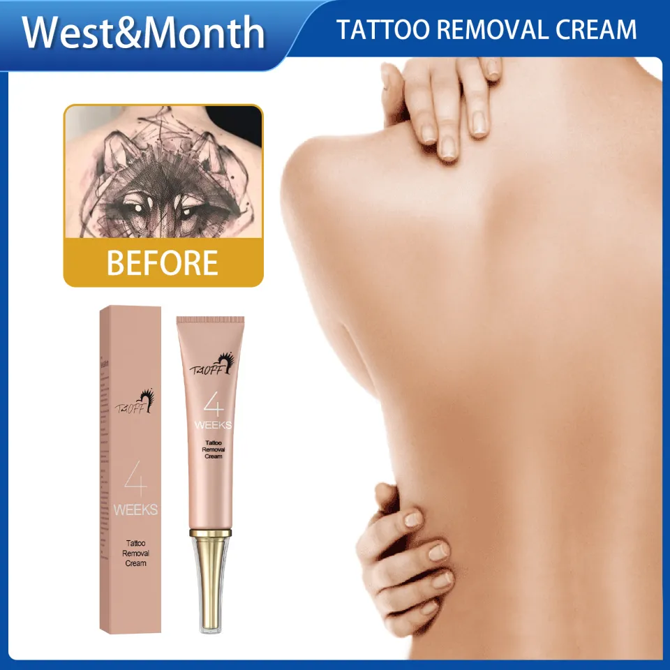 West Month Tattoo Removal Cream Body