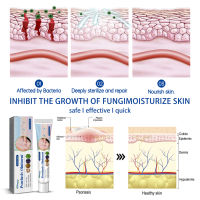 ครีมรักษาอาการคันการรักษาการบรรเทาให้ความชุ่มชื่นที่ผิวหนังสำหรับ Antipruritic ต้านเชื้อแบคทีเรียเครื่องฟื้นฟูผิว