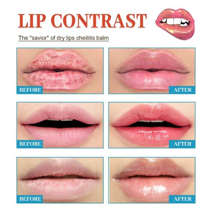 【Authentic Authorization】Lip Cream Reduce Fine Lines Remove Black Lips