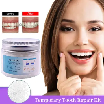 1PC Temporary Tooth Repair Kit False Teeth Solid Glue Denture for Missing  Broken Teeth Moldable Tooth - buy 1PC Temporary Tooth Repair Kit False  Teeth Solid Glue Denture for Missing Broken Teeth