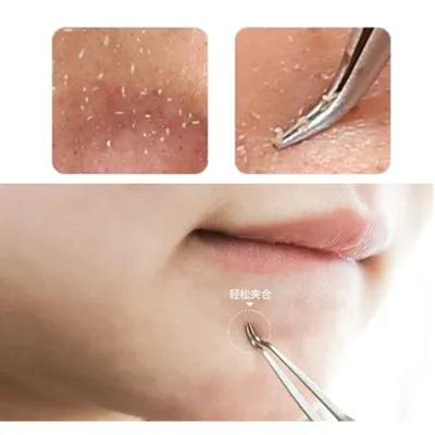 Useful Stainless steel Straight Bend Curved Blackhead Acne Clip Tweezer Pimple Comedone Remover Kit Face Cleaner