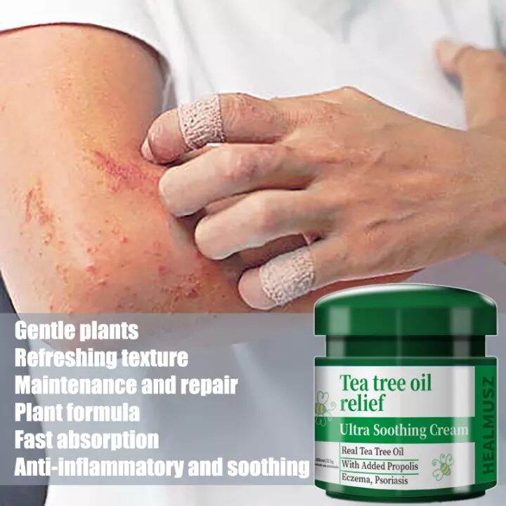 Herbal Antibacterial Ointment Eczema Treatment Cream Antiitch