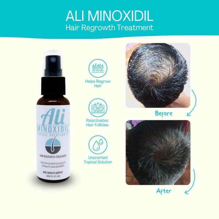 Ali Hair Grower Minoxidil 5% Hair Growth Treatment 50ml 