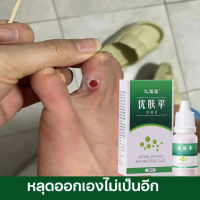 wart removal liquid เอสเซ้นลอกหูด 10ml ยาแต้มหูด ลอกหูดตาปลา ปลอดภัยไม่เจ็บตัว ขจัดติ่งเนื้อ เอสเซ้นลอกหูด ไม่ทิ้งร่องรอยป ครีมกําจัดไฝหูดติ่งเนื้อ