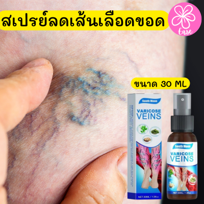 Varicose veins spray ทรีทเม้นท์นวดบรรเทาอาการเส้นเลือดขอด สเปรย์ฉีดเส้นเลือดขอด ขนาด 30 ML