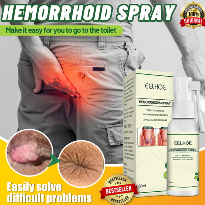 hemorrhoids miracle ointment hemorrhoid cream hemorrhoids cream