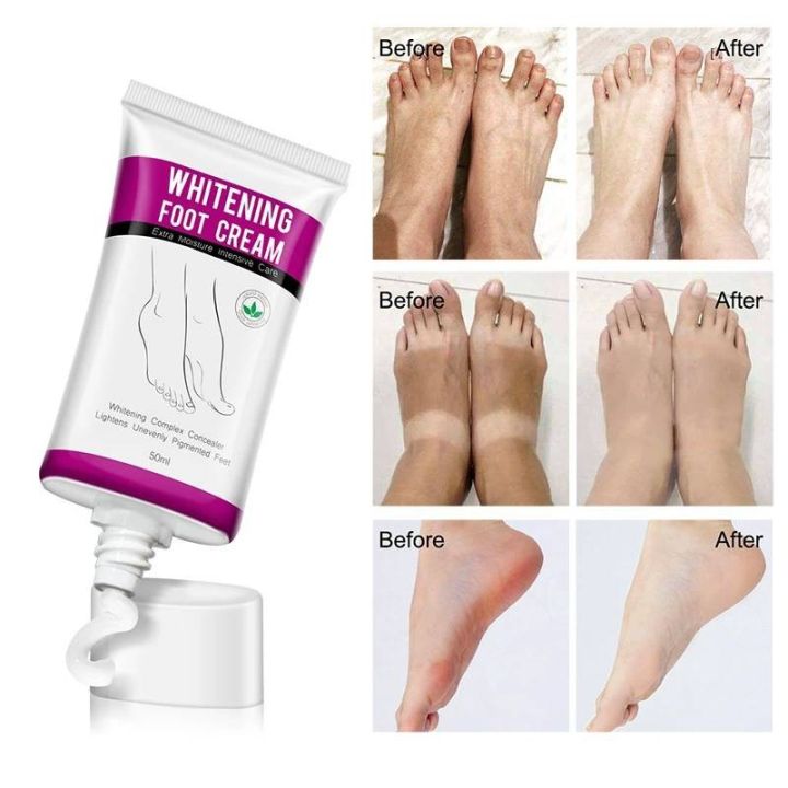 best-seller-ของแท้-แน่นอน-ส่งเร็ว-สินค้าขายดี-whitening-extra-moisturizing-treatment-foot-cream-hydrating-smooth-delicate-foot-skin-care-ไม่ระบุชื่อหน้ากล่อง