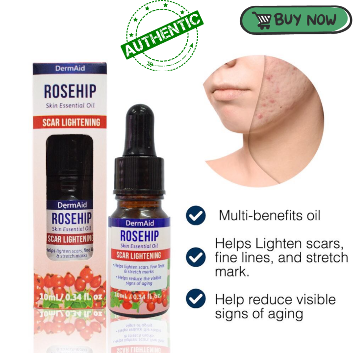 ROSEHIP Pure Skin Essential Oil Scar 10ML DermAid/ BEST SELLER FACIAL