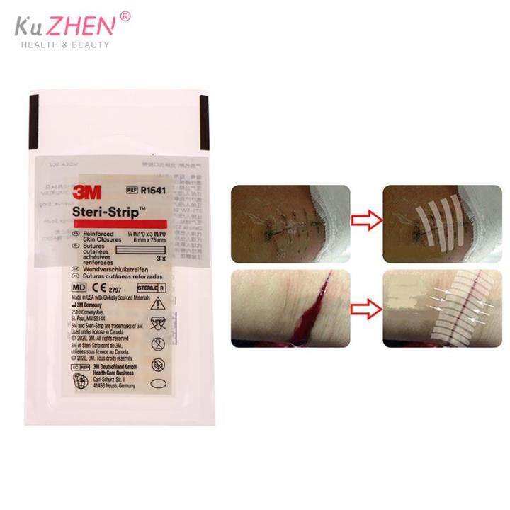 1-bag-sterile-wound-skin-closure-strip-tape-for-surgical-wound-and-cosmetic-surgery-medical-surgical-tape-suture