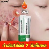 โปรโมชั่น : กำจัดสิว 20ML ลดสิวเสี้ยนครีมรักษาสิว สลายสิวอุดตันที่ต้นตอ อ่อนโยนและไม่ระคาย ครีมลดสิว ครีมกำจัดสิว เจลแต้มสิว โปรโมชั่น : กำจัดสิว 20ML ลดสิวเสี้ยนครีมรักษาสิว สลายสิวอุดตันที่ต้นตอ อ่อนโยนและไม่ระคาย ครีมลดสิว ครีมกำจัดสิว เจลแต้มสิว