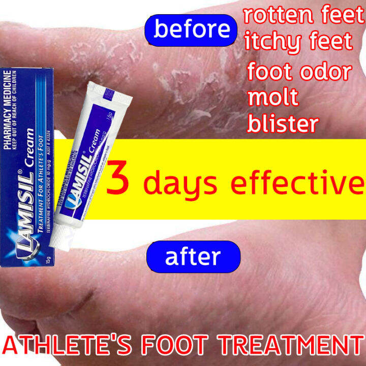 100 Safe and Effective LAMISIL Foot Cream Treats Athletes Foot Anti