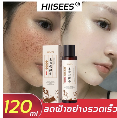 HIISEES 120m ช่วยปัญหาเรื่อง ฝ้า จุดด่างดำ กระ ริ้วรอย**ของแท้ พร้อมส่ง