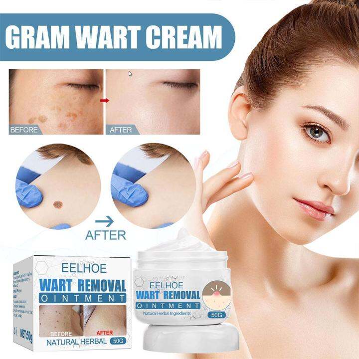 EELHOE Wart Remover Skin Wart Removal Cream Warts Cream Foot Care Cream ...